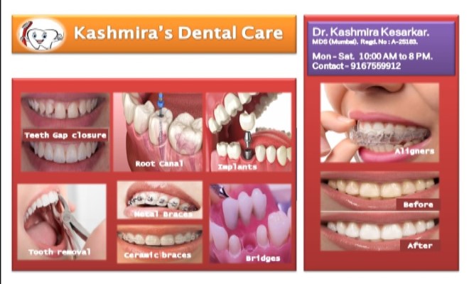 Kashmira's Dental Care - Dentist in Andheri East